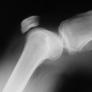 Image - Lateral x-ray of knee